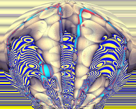 Are my brains falling apart?